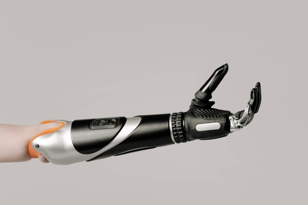 3D-Printed Prosthetics