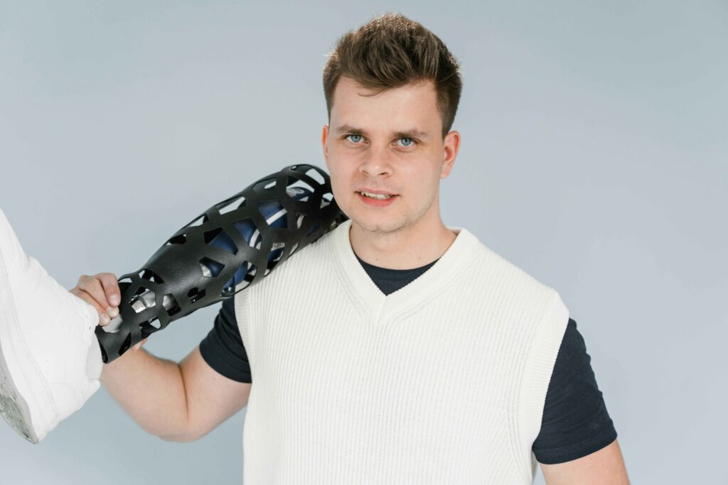 3D-Printed Prosthetics